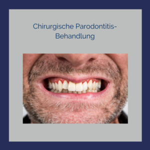 Chirurgische Parodontitis-Behandlung in Nürnberg
